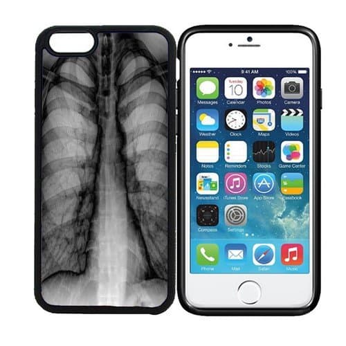 iPhone 6 (4.7 inch display) Designer Black Case - Chest X Ray Radiology
