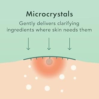 Rael Microneedle Acne Healing Patch - Pimple Acne Spot Tea Tree Treatment (3 Pack, 27 Patches)