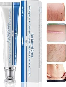 Scar Removal Cream, Scar Healing Cream, Scar Cream for Face, Cream for Scars for Stretch Marks, C-Sections, Burns, Scalds, Acne, Surgery, New and Old Scars, Natural Scar Gel Burn Scar Removal(2PCS)