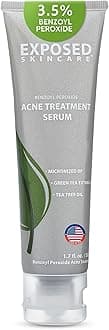 Exposed Skin Care, Acne Treatment Serum with 3.5% Benzoyl Peroxide – Lightweight Acne Spot Treatment – Quickly Clear Teen, Adult, Hormonal and Cystic Acne – Natural, Non-toxic and Cruelty Free